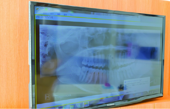 説明用モニター