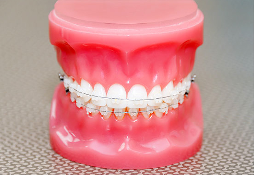 矯正歯科・小児矯正歯科